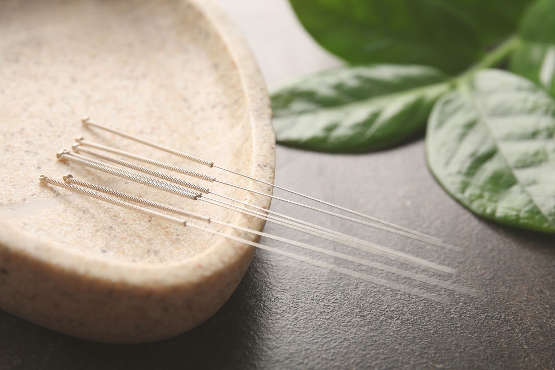 Acupuncture6